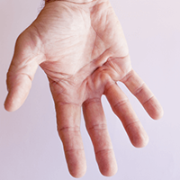 Trigger Finger Release